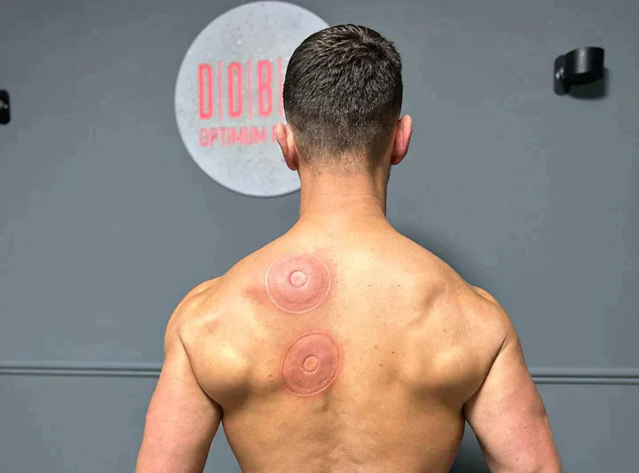 Cintera™ Smart Cupping Therapy Massager